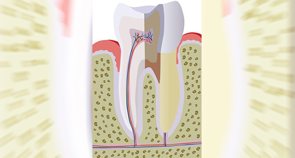 Endodontie