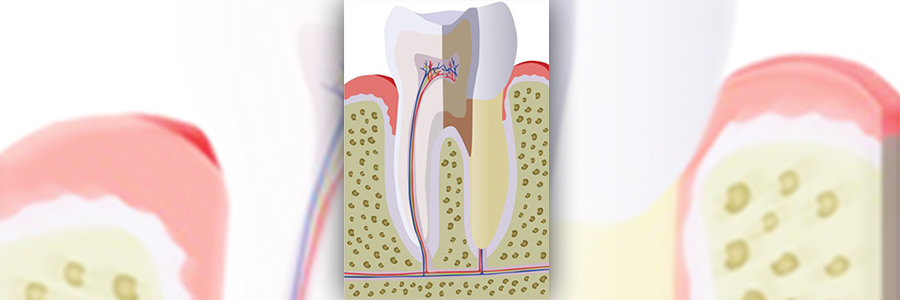 Zahnarzt Widmer Endodontie